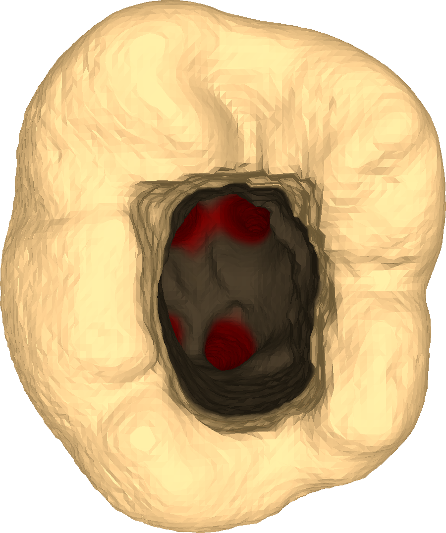 Top view of an acceptable drilling outcome