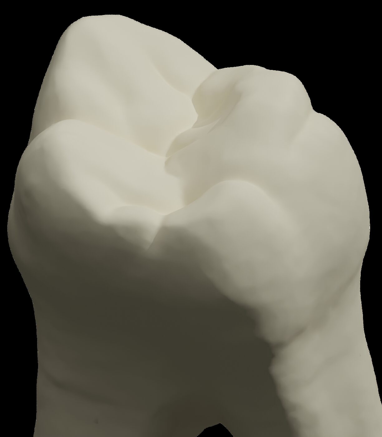 Tooth #16 model mesh