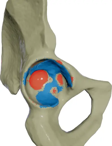 Under-reamed material in blue